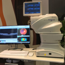oct prevención glaucoma
